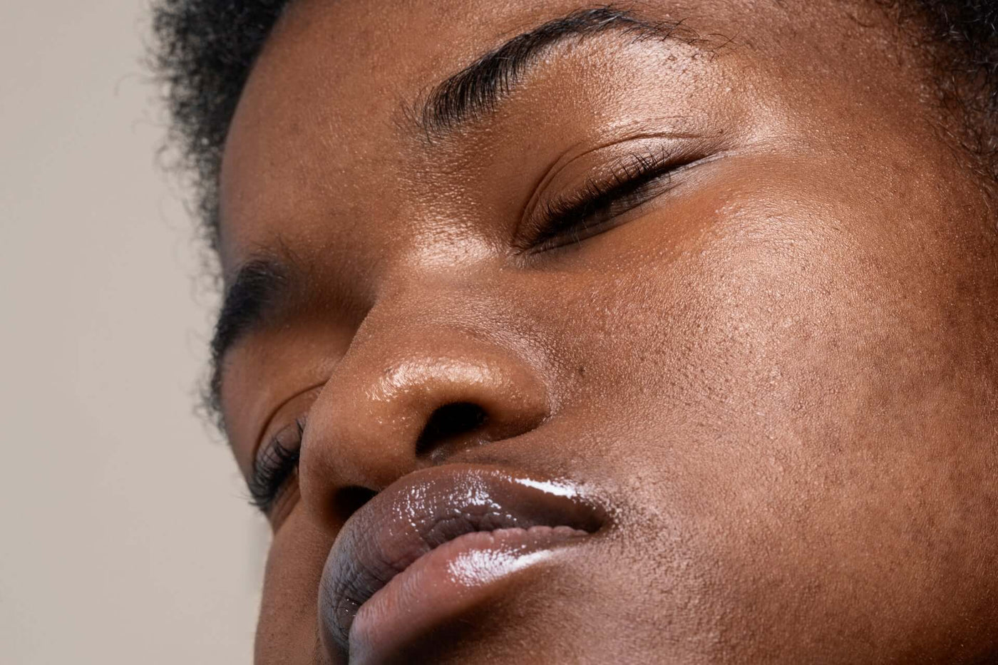 Melasma em pele negra: como identificar e principais cuidados