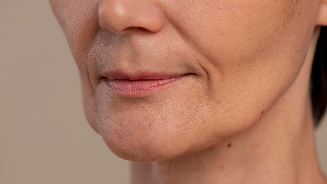 Flacidez no rosto: saiba o que é, como prevenir e tratar