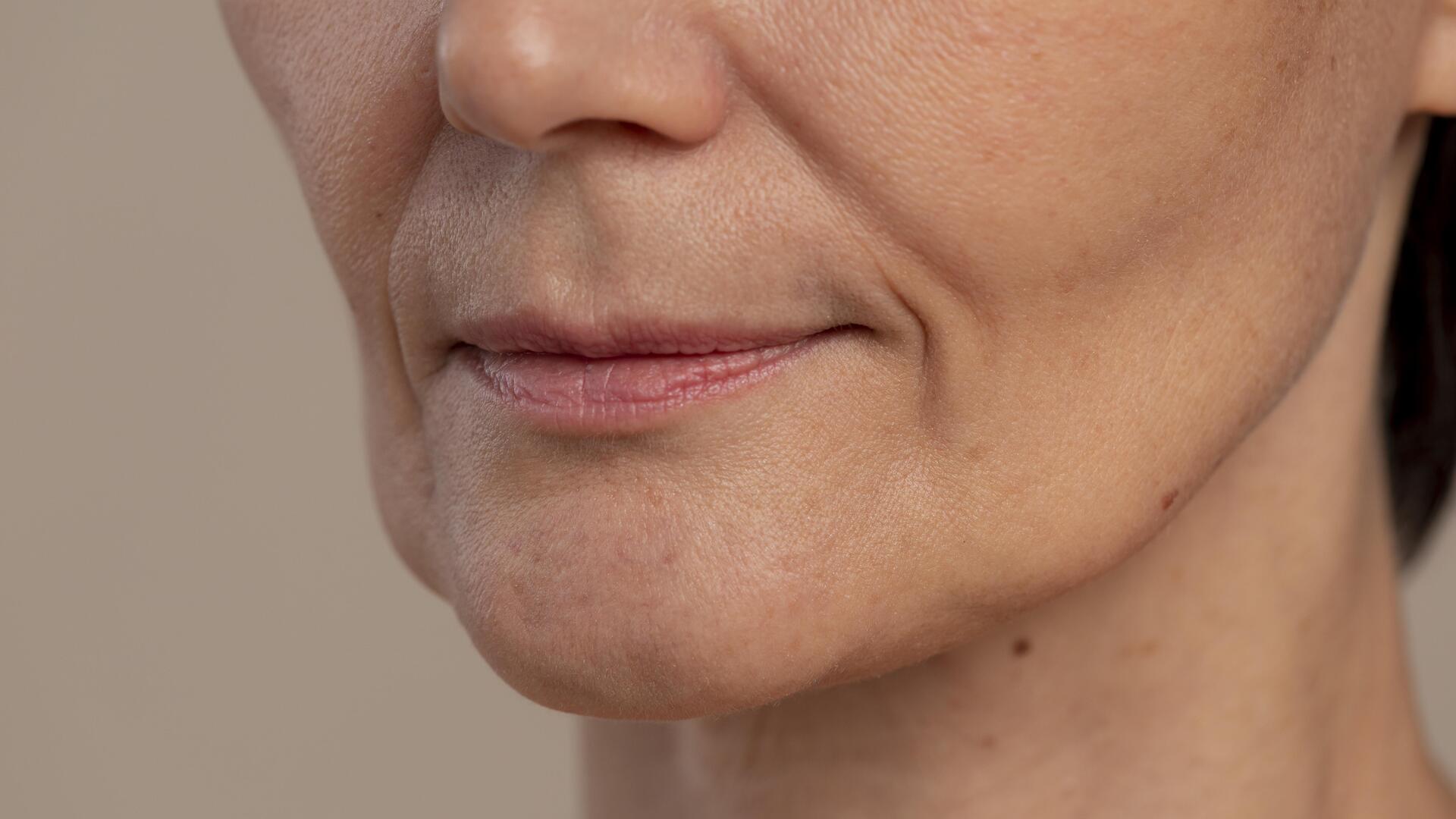 Flacidez no rosto: saiba o que é, como prevenir e tratar