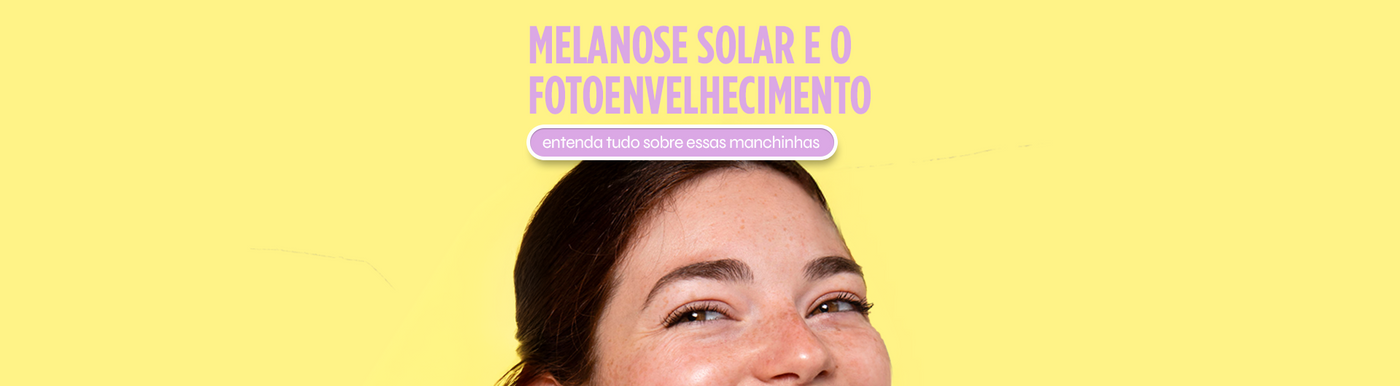 Melanose Solar e Fotoenvelhecimento